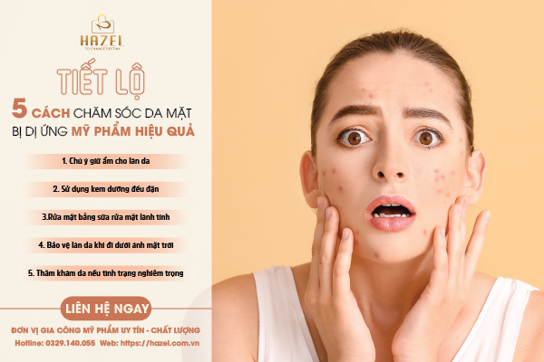 Cách chăm sóc da mặt bị dị ứng mỹ phẩm: Sử dụng kem dưỡng đều đặn